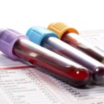 blood test vials