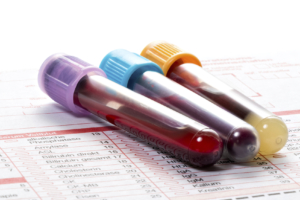 blood test vials